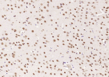 Alpha B Crystallin Rabbit Polyclonal Antibody