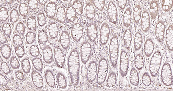 BARD1 Rabbit Polyclonal Antibody
