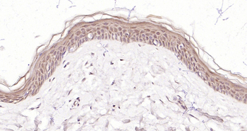 BARD1 Rabbit Polyclonal Antibody