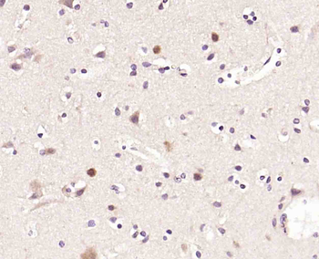 Ack1 Rabbit Polyclonal Antibody
