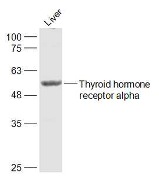 Thyroid hormone receptor alpha Rabbit Polyclonal Antibody