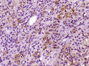 ACTH (1-39) Rabbit Polyclonal Antibody