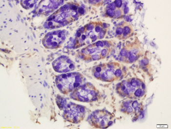 RNA polymerase II CTD repeat YSPTSPS (phospho S2) Rabbit Polyclonal Antibody
