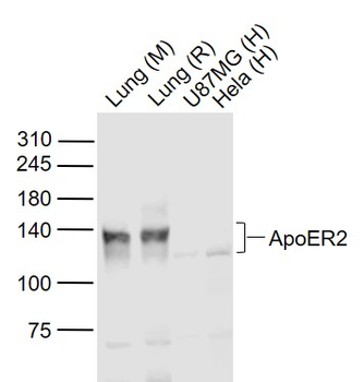ApoER2 Rabbit Polyclonal Antibody