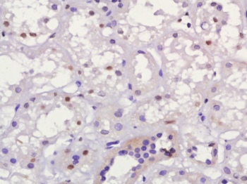 MUM1 Rabbit Polyclonal Antibody