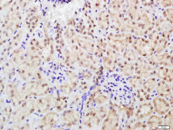 MUM1 Rabbit Polyclonal Antibody