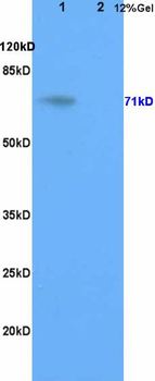 Galactocerebrosidase Rabbit Polyclonal Antibody