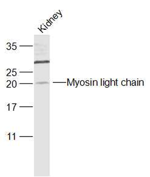 Myosin light chain (phospho S20) Rabbit Polyclonal Antibody