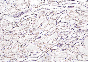 Phospho-TIRAP (Tyr86) Rabbit Polyclonal Antibody