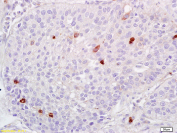 ADAMTS1 Rabbit Polyclonal Antibody