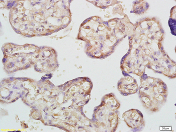 ADAMTS7 Rabbit Polyclonal Antibody