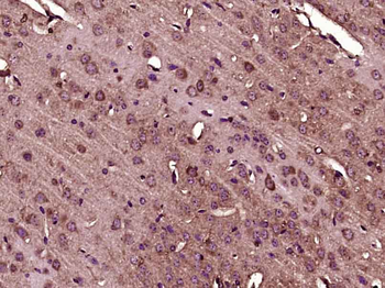 ADAMTS7 (NT) Rabbit Polyclonal Antibody