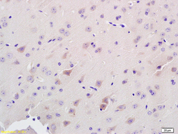 ADAMTS7 (NT) Rabbit Polyclonal Antibody