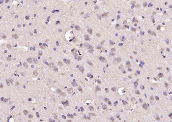 TP53TG5 Rabbit Polyclonal Antibody