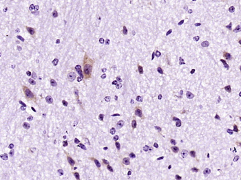 Phospho-FRS2 (Tyr436) Rabbit Polyclonal Antibody