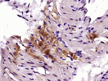 Phospho-FRS2 (Tyr436) Rabbit Polyclonal Antibody