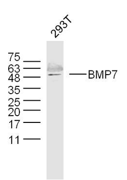 BMP7 Rabbit Polyclonal Antibody