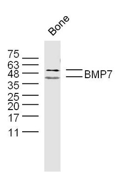 BMP7 Rabbit Polyclonal Antibody