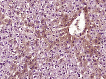 VEGFA Rabbit Polyclonal Antibody