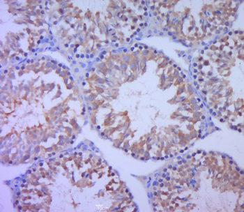 CIAP1 Rabbit Polyclonal Antibody