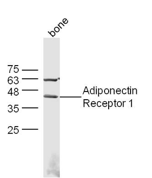 Adiponectin Receptor 1 Rabbit Polyclonal Antibody