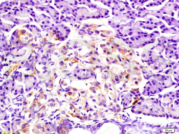 Adiponectin Receptor 1 Rabbit Polyclonal Antibody