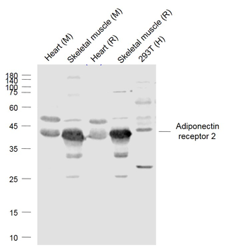 Adiponectin receptor 2 Rabbit Polyclonal Antibody
