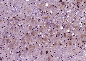 FGF20 Rabbit Polyclonal Antibody