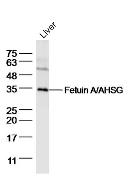 Fetuin A/AHSG Rabbit Polyclonal Antibody