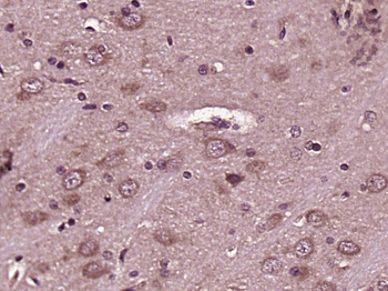 PHLP Rabbit Polyclonal Antibody