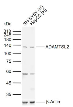 ADAMTSL2 Rabbit Polyclonal Antibody