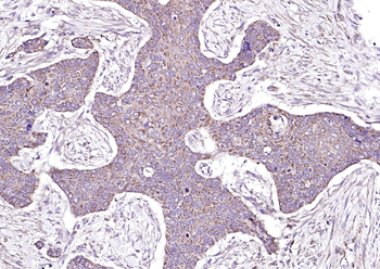CTHRC1 Rabbit Polyclonal Antibody