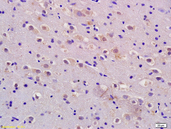 ADM Rabbit Polyclonal Antibody