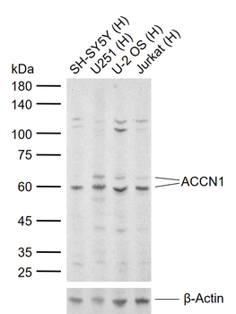 ACCN1 Rabbit Polyclonal Antibody