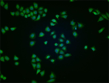 Clathrin heavy chain Rabbit Polyclonal Antibody