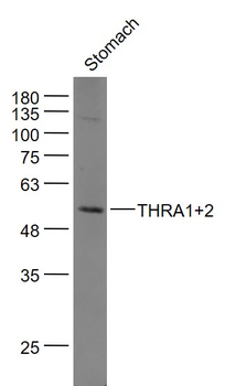 THRA1+2 Rabbit Polyclonal Antibody