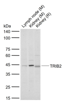 TRIB2 Rabbit Polyclonal Antibody