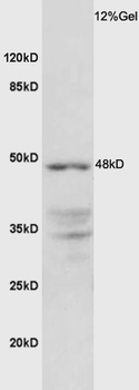Testin Rabbit Polyclonal Antibody
