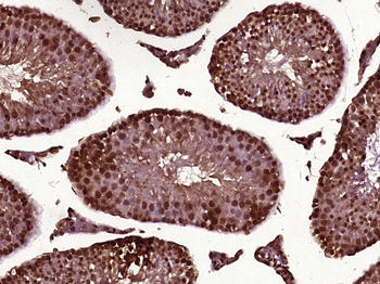 Epithelial Stromal Interaction 1 Rabbit Polyclonal Antibody