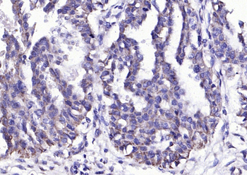 PAI1 Rabbit Polyclonal Antibody