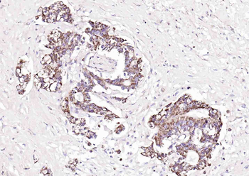 PAI1 Rabbit Polyclonal Antibody