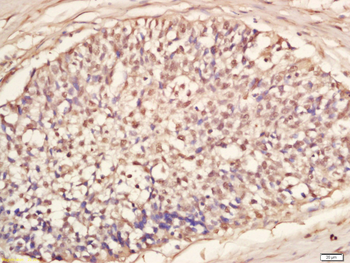 RNA polymerase II CTD repeat YSPTSPS (phospho S5) Rabbit Polyclonal Antibody