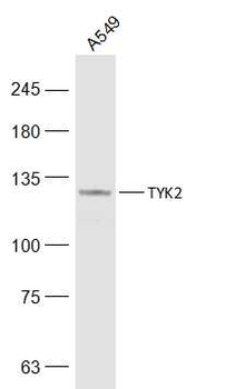 TYK2 Rabbit Polyclonal Antibody