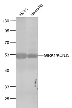 GIRK1/KCNJ3 Rabbit Polyclonal Antibody