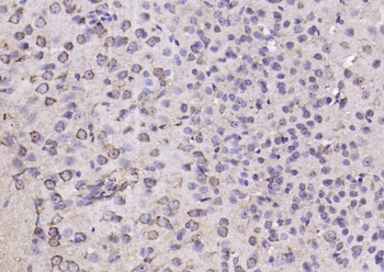 SDF4 Rabbit Polyclonal Antibody