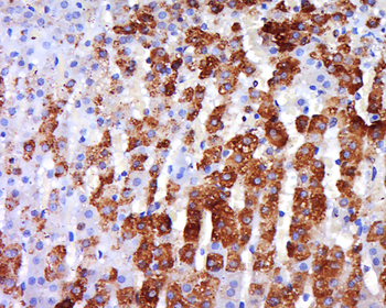 ADRB3 Rabbit Polyclonal Antibody