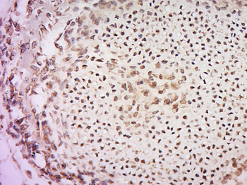APPD Rabbit Polyclonal Antibody