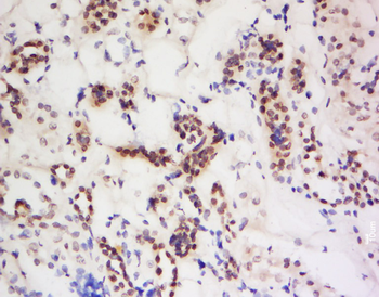 PIWIL4 Rabbit Polyclonal Antibody