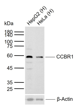 CCBR1 Rabbit Polyclonal Antibody