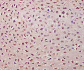 TSPYL5 Rabbit Polyclonal Antibody